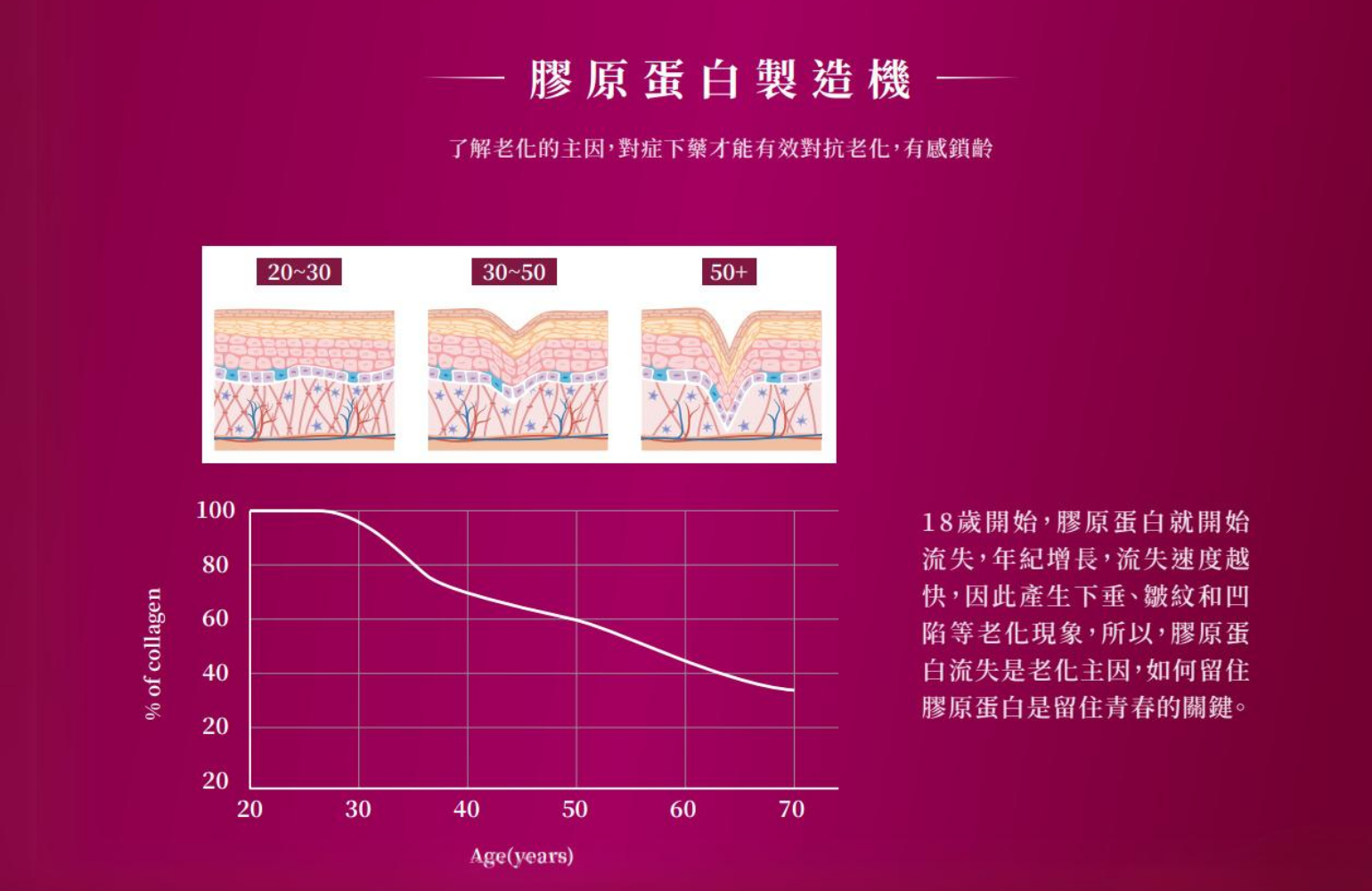 5.webp